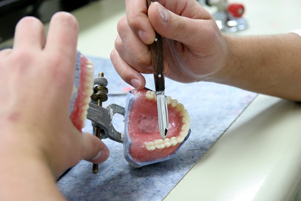 A Guide To Getting A Full Mouth Reconstruction